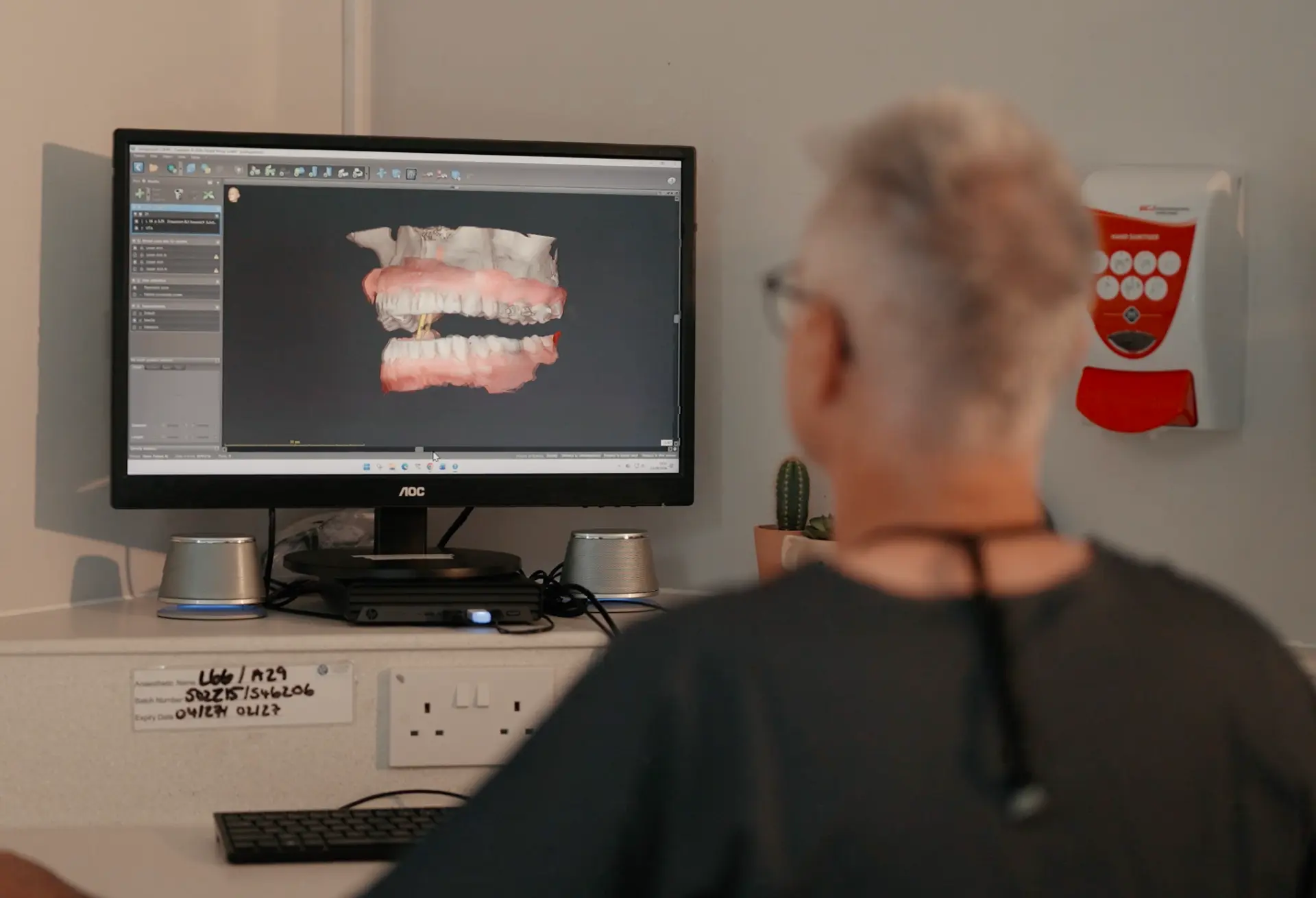 Digital smile design preview of veneers on screen at Cadbury Dental, Birmingham