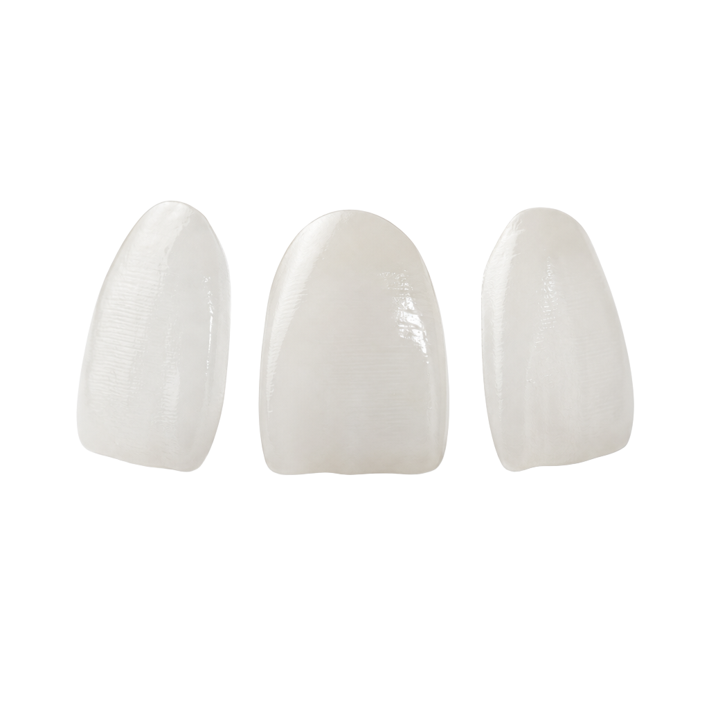 A restored, natural smile after crown and bridge treatment in Birmingham